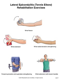 tennis elbow exercises, ورزش در آرنج تنیس بازان